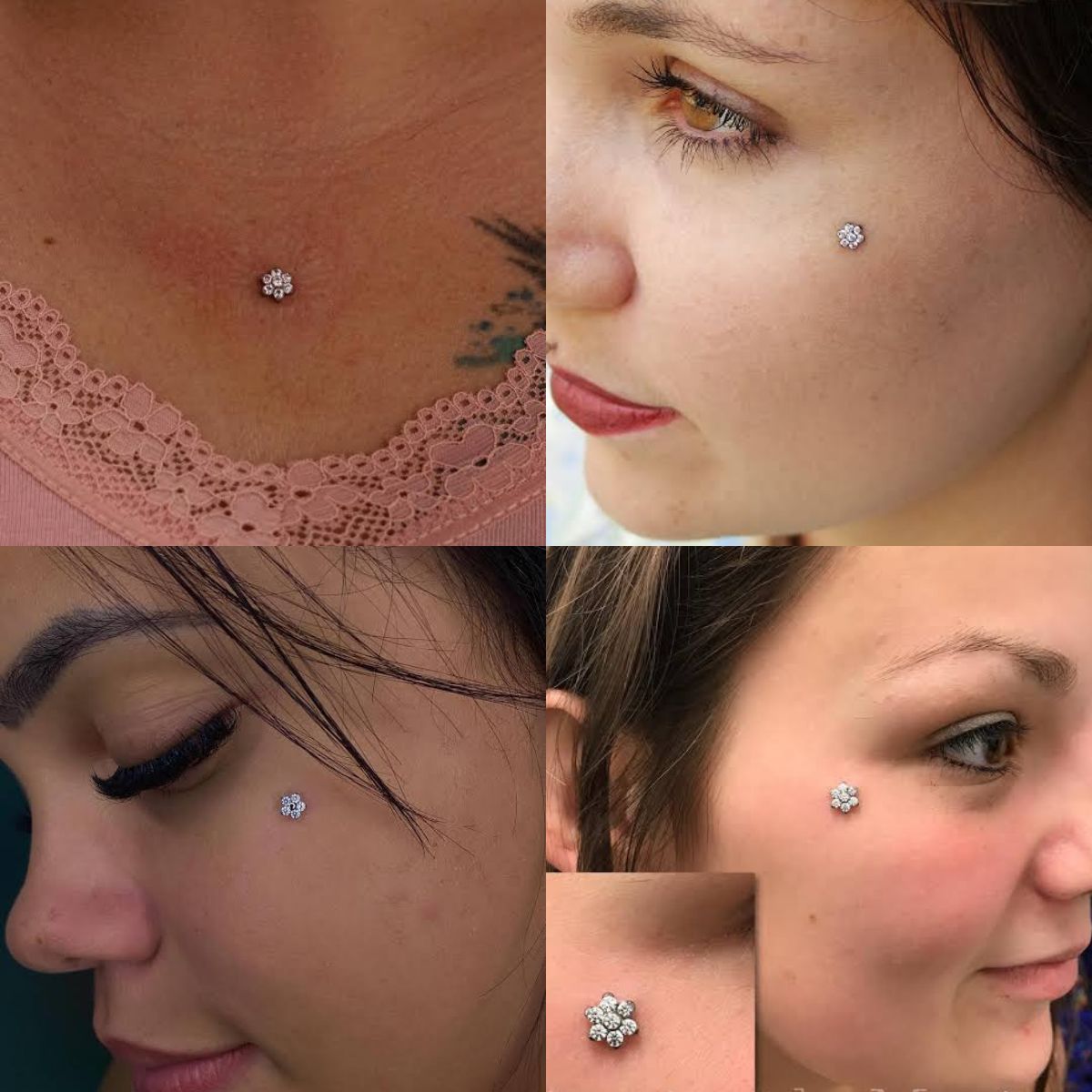 Microdermal Flor Helsinque