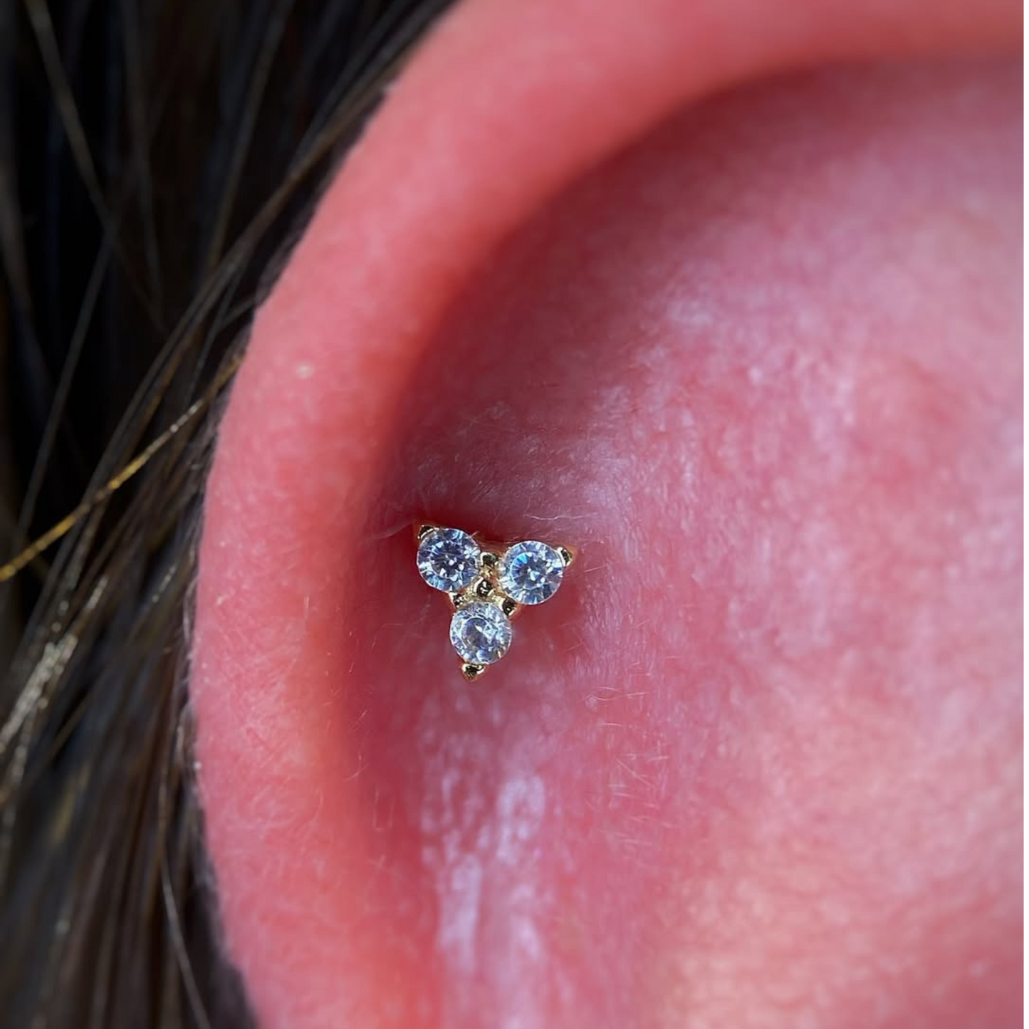 Trinity zircônia Toronto