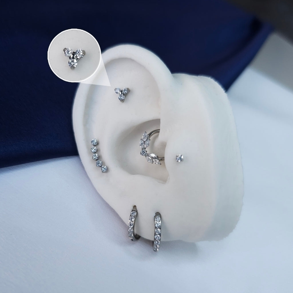 Trinity zircônia Toronto