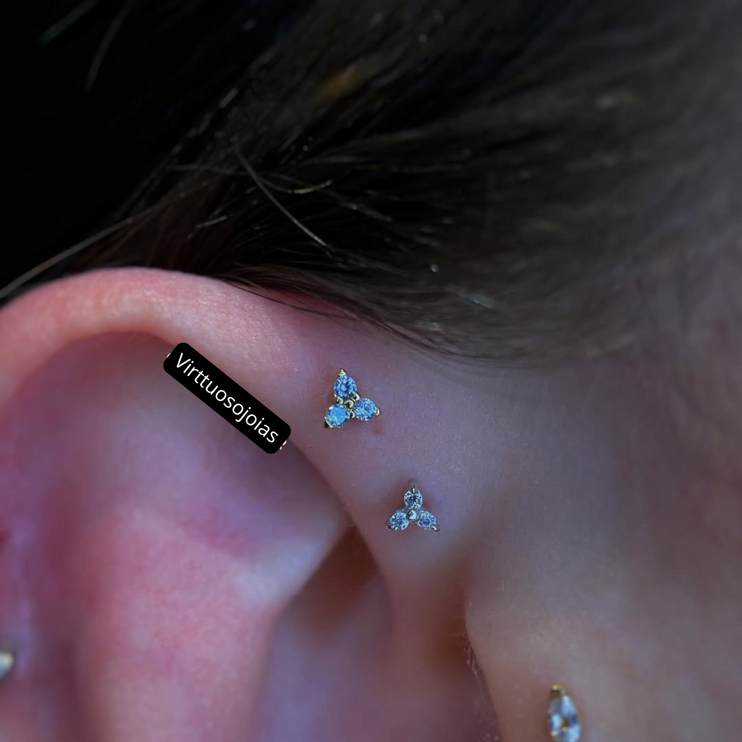 Trinity zircônia Toronto