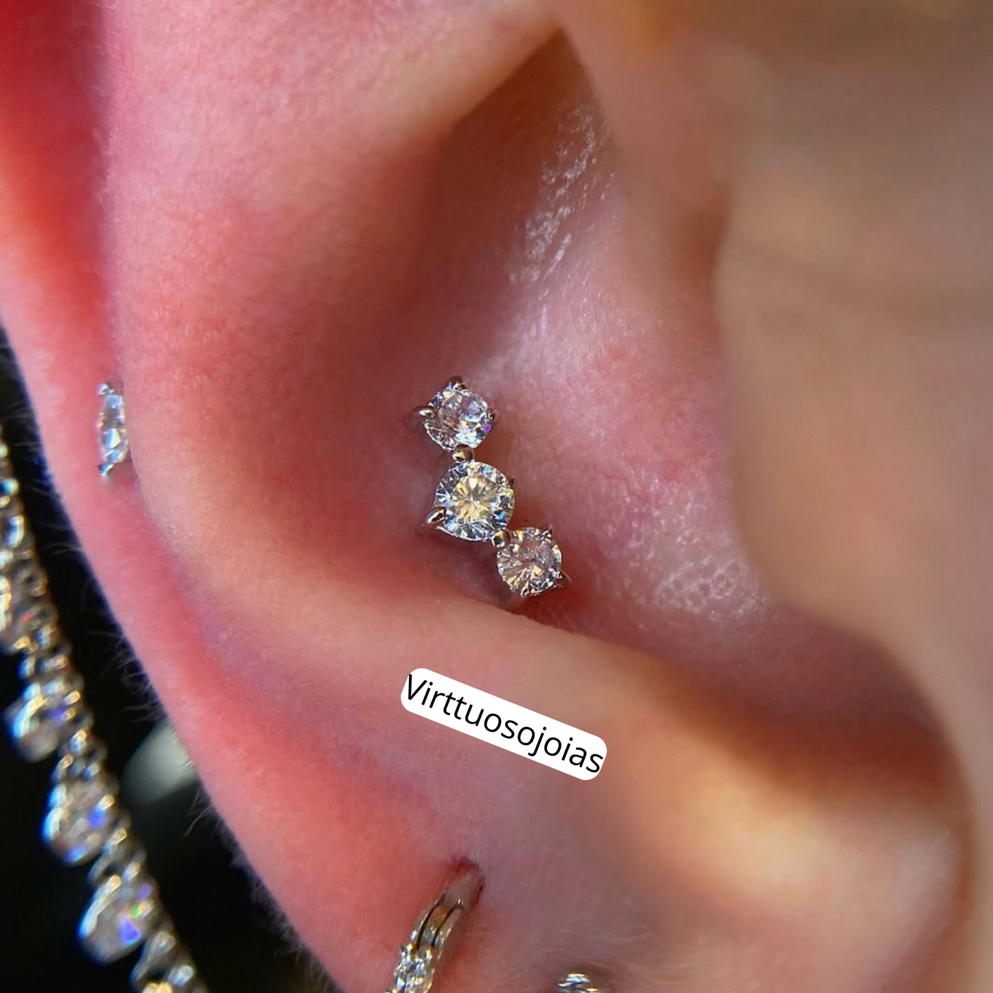 Cluster zircônia Madri