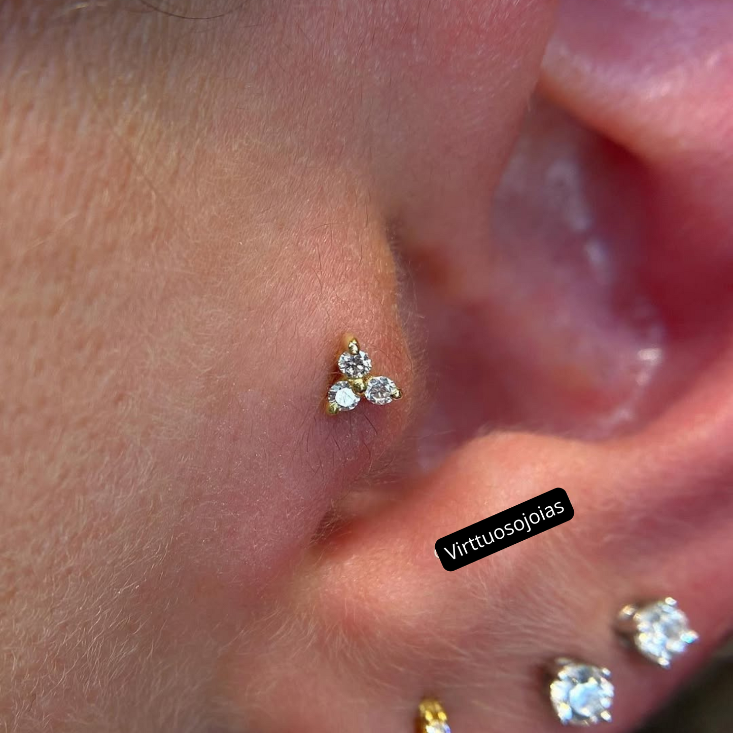 Trinity zircônia Toronto